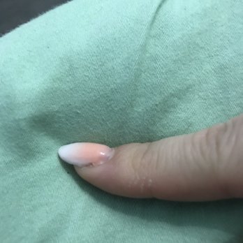 Botanix Nail Spa - Edge of the nail isn't even so it will probably start lifting there soon - Nail Salons Near Me - Newark, Delaware Botanix Nail Spa - Edge of the nail isn't even so it will probably start lifting there soon - Nail Salons Near Me - Newark, Delaware