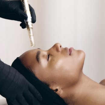 Glow Haus - Acne Treatment Near Me - Manhattan Beach, California Glow Haus - Acne Treatment Near Me - Manhattan Beach, California