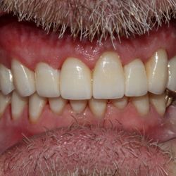 Affinity Smiles Dental Pllc - Cosmetic and Family Dentistry in Roanoke, TX
