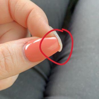 Guppy Nail - Acrylic chunks at the top of my nail that she didn't clean out - Nail Salons Near Me - Hollywood, Florida Guppy Nail - Acrylic chunks at the top of my nail that she didn't clean out - Nail Salons Near Me - Hollywood, Florida