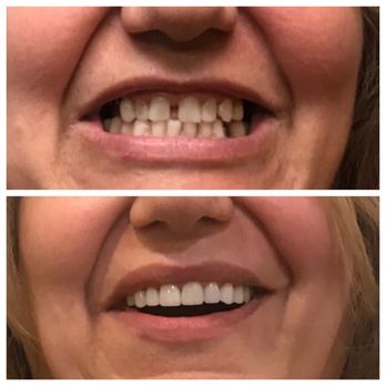 Karen Arakelian DDS - General Dentistry Near Me - Sherman Oaks, California Karen Arakelian DDS - General Dentistry Near Me - Sherman Oaks, California
