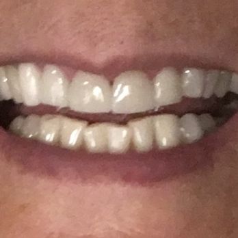 Corey K Fujita, DDS - New smile - General Dentistry Near Me - Newport Beach, California Corey K Fujita, DDS - New smile - General Dentistry Near Me - Newport Beach, California