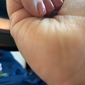 LuXe Nails - Look at the pinky finger corner. It looks awful visually and uneven. Also my cuticles got zero attention. - Nail Salons Near Me - Indianapolis, Indiana LuXe Nails - Look at the pinky finger corner. It looks awful visually and uneven. Also my cuticles got zero attention. - Nail Salons Near Me - Indianapolis, Indiana