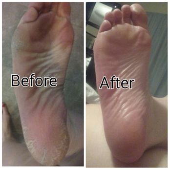Lux Nails & Spa - I had tried everything & my foot skin was still wrecked. After pedicure, I was able to file it down more at home to get it perfect. 8/18/16 - Nail Salons Near Me - Las Vegas, Nevada