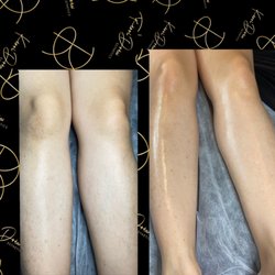KerriDrew Esthetics - Leg wax!!!