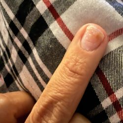 Vip Nails - The brown fungus