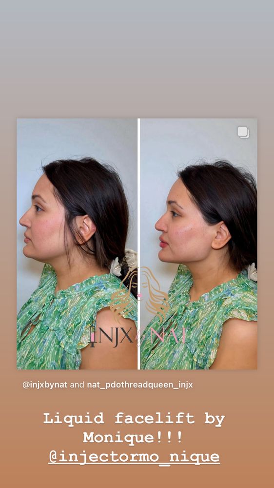 INJX BY NAT Updated October 2024 28 Photos 45 S Ave W, Cranford