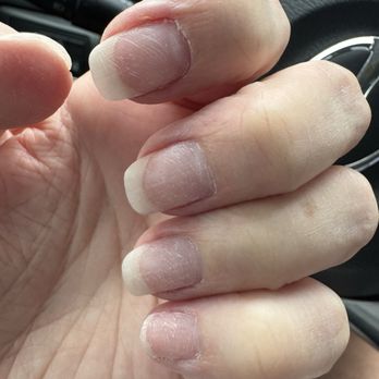 Expert Nails & Spa - My rough messed up nails. - Day Spas Near Me - Orlando, Florida Expert Nails & Spa - My rough messed up nails. - Day Spas Near Me - Orlando, Florida