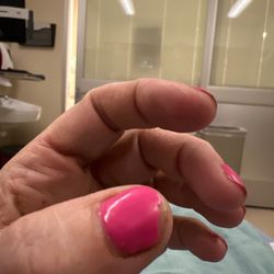 Nicole's - Thumb nail chipping