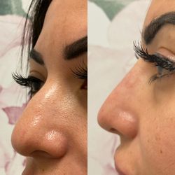 Glow St. Pete - Nose filler by Galena Neal