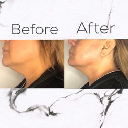 Truly Yours Body Sculpting