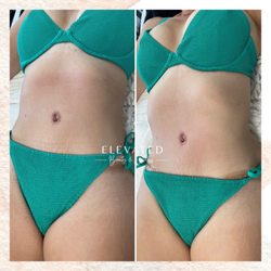 Fifth Element Beauty - Wood Therapy + Lymphatic Massage