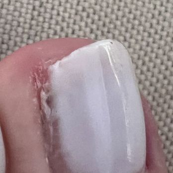 Nail Fever - cracked nail using cuticle clippers and chunks of gel left uneven jagged edges - Nail Salons Near Me - Atlanta, Georgia Nail Fever - cracked nail using cuticle clippers and chunks of gel left uneven jagged edges - Nail Salons Near Me - Atlanta, Georgia