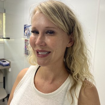 Windsor Dermatology - Right after Botox! - Dermatologists Near Me - East Windsor, New Jersey Windsor Dermatology - Right after Botox! - Dermatologists Near Me - East Windsor, New Jersey