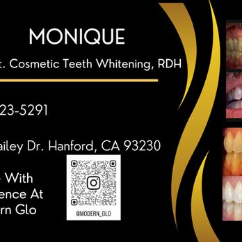 Modern Glo - Teeth Whitening Near Me - Hanford, California