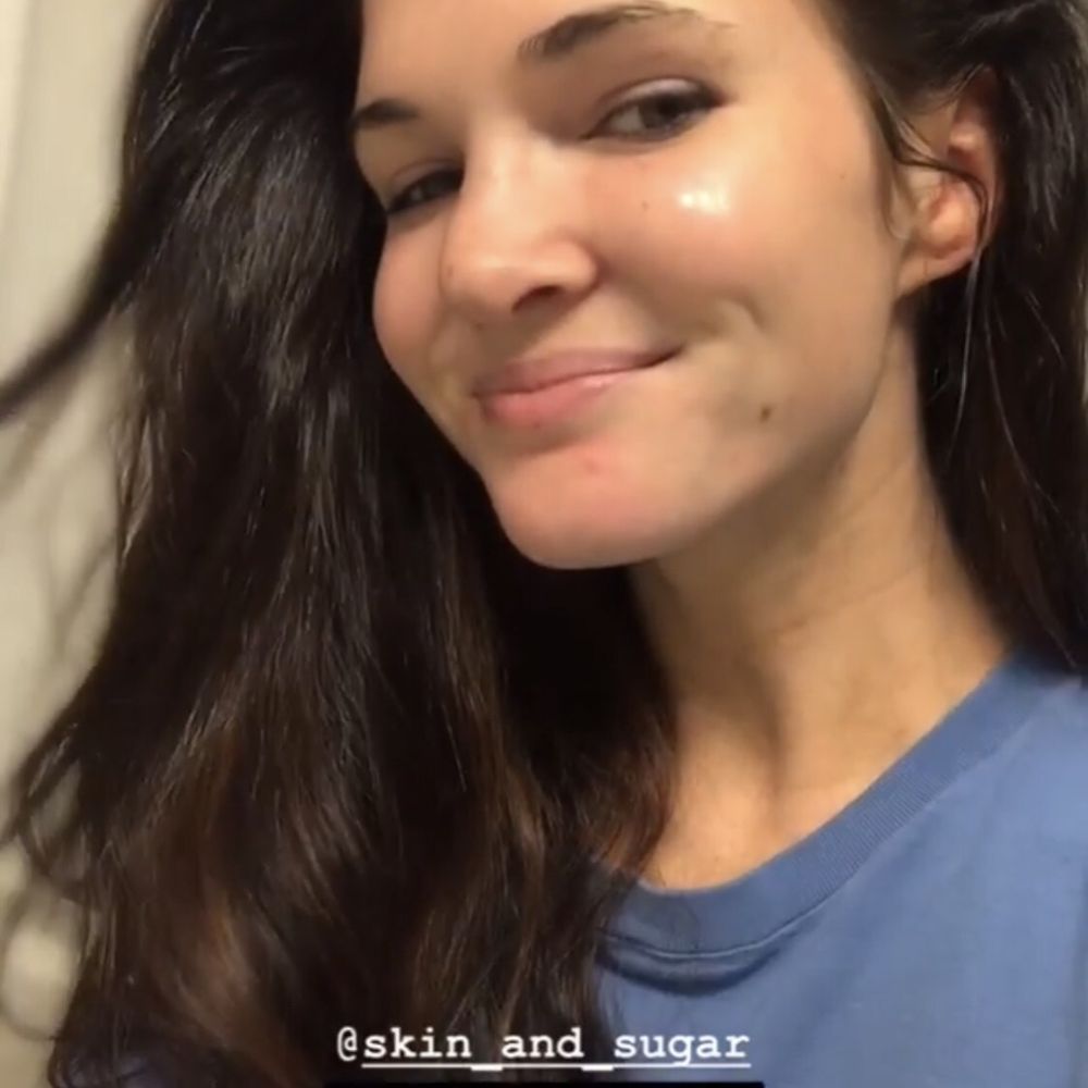 Skin & Sugar - After - Skin Care Near Me - Upper Arlington, Ohio Skin & Sugar - After - Skin Care Near Me - Upper Arlington, Ohio