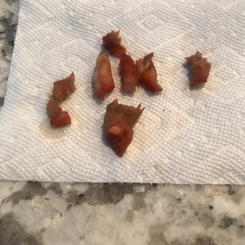 Panda Garden - a piece of bacon on a napkin - Chinese Near Me - Wake Forest, North Carolina Panda Garden - a piece of bacon on a napkin - Chinese Near Me - Wake Forest, North Carolina
