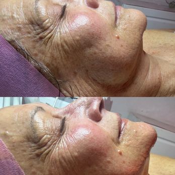 Perfect Skin - Estheticians Near Me - Costa Mesa, California Perfect Skin - Estheticians Near Me - Costa Mesa, California