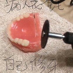 Titanium Dental Implants and Periodotics - 为什么?