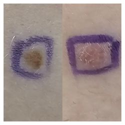 Halo Skin Institute - Two areas of concern.