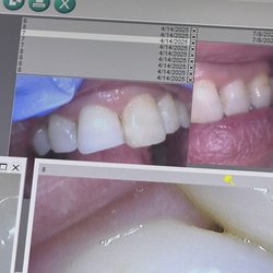 Right front tooth shorter how can you do this to someone?