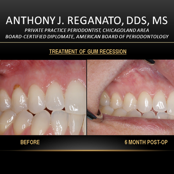 Cpid - Periodontists Near Me - Buffalo Grove, Illinois Cpid - Periodontists Near Me - Buffalo Grove, Illinois