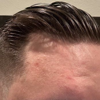 Great Clips - This side is not as bad, but the parted side is awful. - Hair Salons Near Me - Wildomar, California Great Clips - This side is not as bad, but the parted side is awful. - Hair Salons Near Me - Wildomar, California