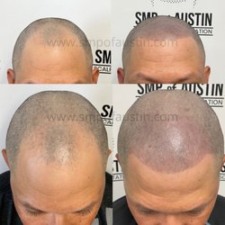 SMP of Austin - So clean and natural!