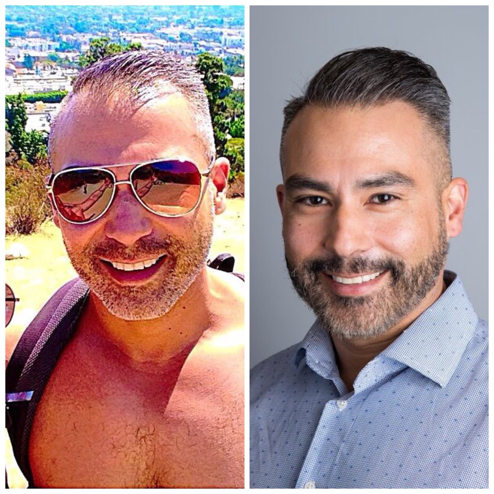 Bosley Hair Transplant Restoration 47 Photos Hair Loss