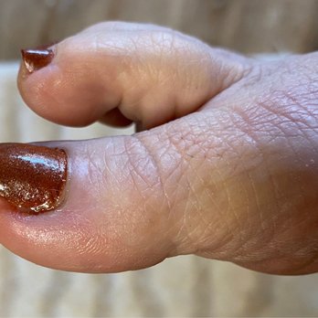 Jenna's Day Spa - Toe nail was cut very poorly & has now caused inflammation & pain at the site. - Day Spas Near Me - Sunnyvale, Texas Jenna's Day Spa - Toe nail was cut very poorly & has now caused inflammation & pain at the site. - Day Spas Near Me - Sunnyvale, Texas