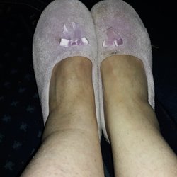 Swollen legs/ankles