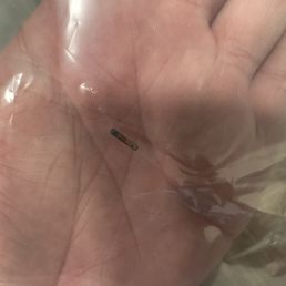 The microchip