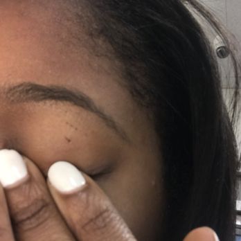 Choice Threading Salon - Cuts under my left eyebrow. - Threading Services Near Me - San Francisco, California Choice Threading Salon - Cuts under my left eyebrow. - Threading Services Near Me - San Francisco, California