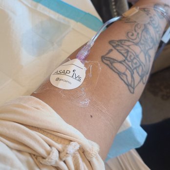 ASAP IVs - Arm with IV - Medical Spas Near Me - Pleasanton, California ASAP IVs - Arm with IV - Medical Spas Near Me - Pleasanton, California
