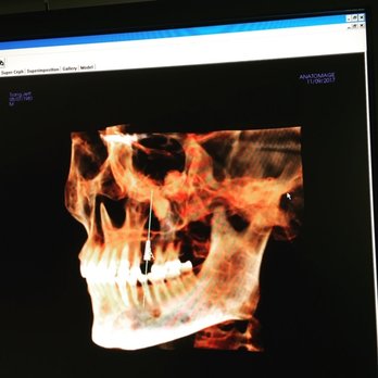 Leonard Lem, DDS, MD - Oral Surgeons Near Me - Glendora CA, California
