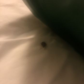 Hampton Inn Chicago-Carol Stream - Bug in the Bed Room 603 - Hotels Near Me - Carol Stream, Illinois
