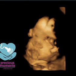 Precious Moments 3D/4D - 3D