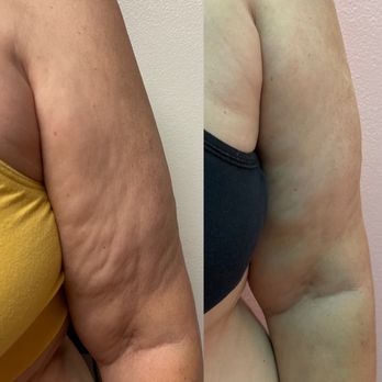 Embodyment - Weight Loss Centers Near Me - Redondo Beach, California Embodyment - Weight Loss Centers Near Me - Redondo Beach, California