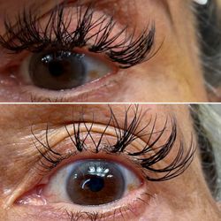 Trish's Lashes - Added recent photo- eyelashes not growing back.