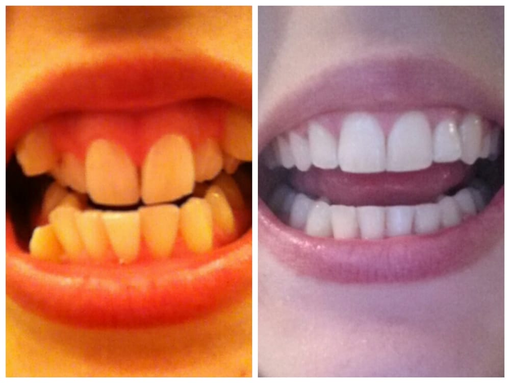 CENTRAL FLORIDA ORTHODONTIC SPECIALISTS Updated August 2024 2555 W