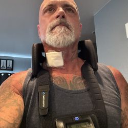 Avista Adventist Hospital - After care with bone growth stimulator.