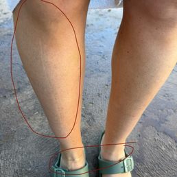 No spray tan on outside of leg and line around my ankles