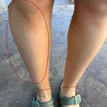 Ageless Aura Aesthetics - No spray tan on outside of leg and line around my ankles - Spray Tanning Near Me - San Jose, California
