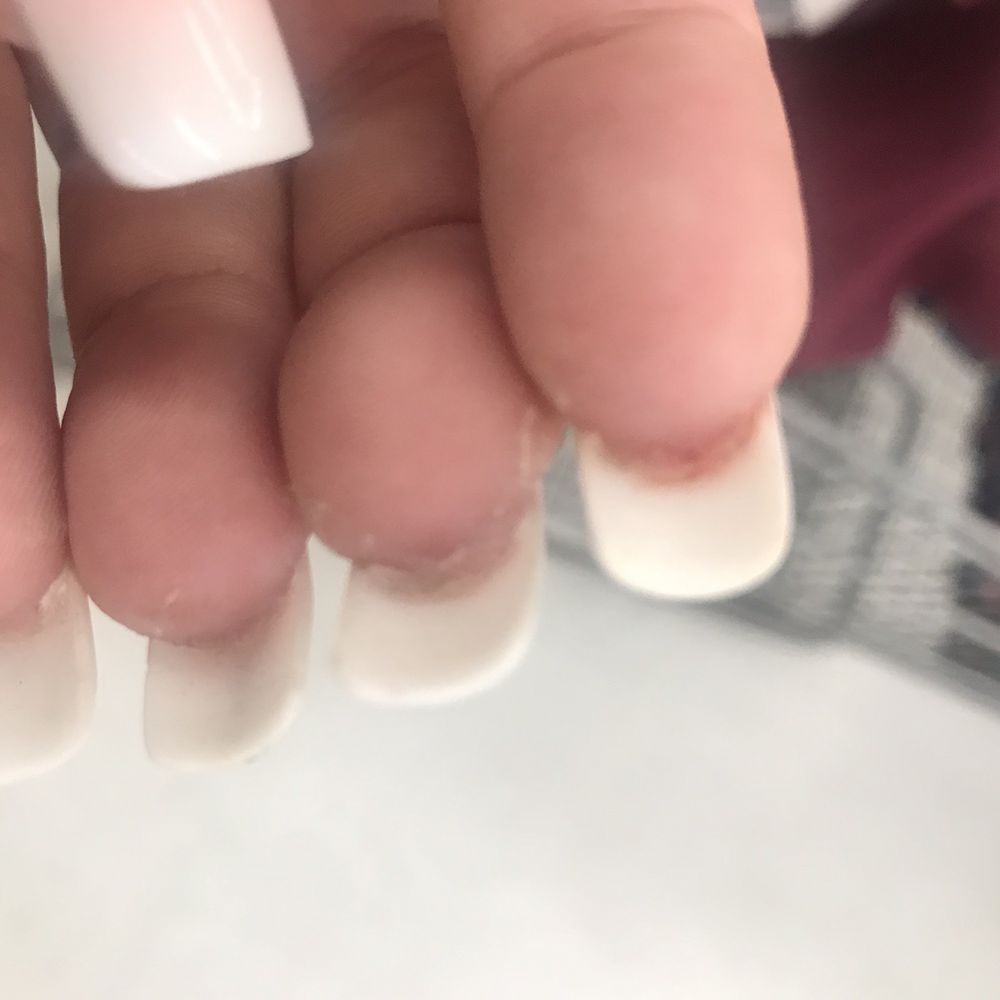 Grand Lux Day Spa Longview - Blood under my nail bed - Day Spas Near Me - Longview, Texas Grand Lux Day Spa Longview - Blood under my nail bed - Day Spas Near Me - Longview, Texas