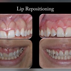 Edelweiss Dental Implant Center