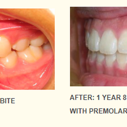Bridge Pointe Orthodontics