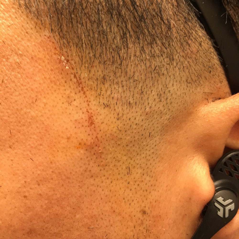 Dominican Barber Shop - Cut me with a straight razor. Then burned me w a topical. - Barbers Near Me - Hempstead, New York