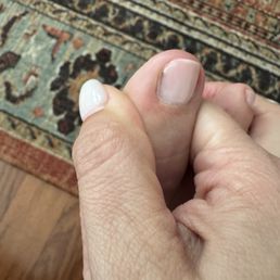 Gel polished dried in a pool on the side of my toe Gel polished dried in a pool on the side of my toe