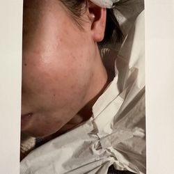 Peebro Skin & Total Health Care - After