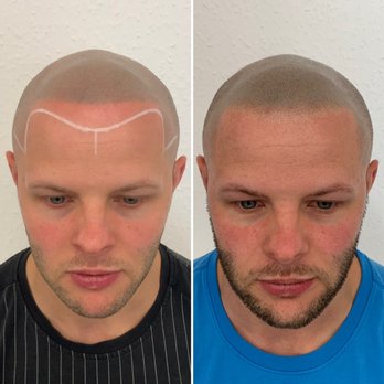 Creative Scalps - Arizona - We can help repair SMP work from other providers. - Hair Loss Centers Near Me - Glendale, Arizona